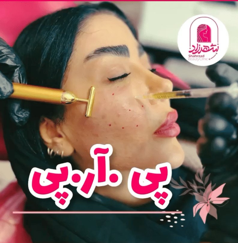 ویدئو نمونه