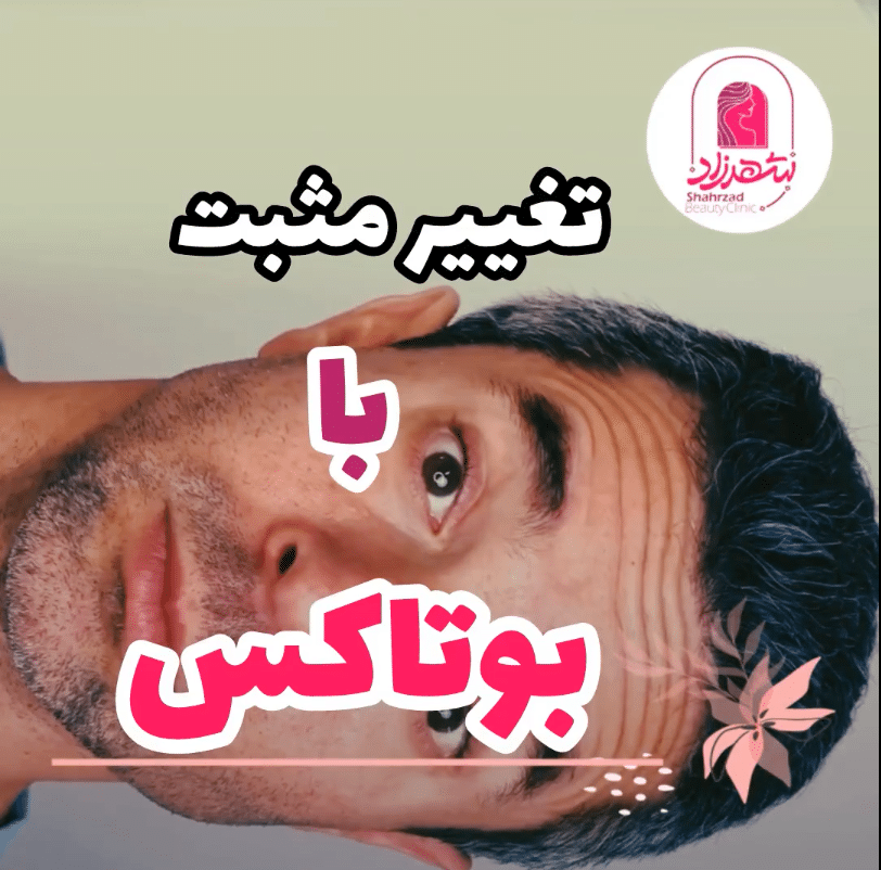 ویدئو نمونه