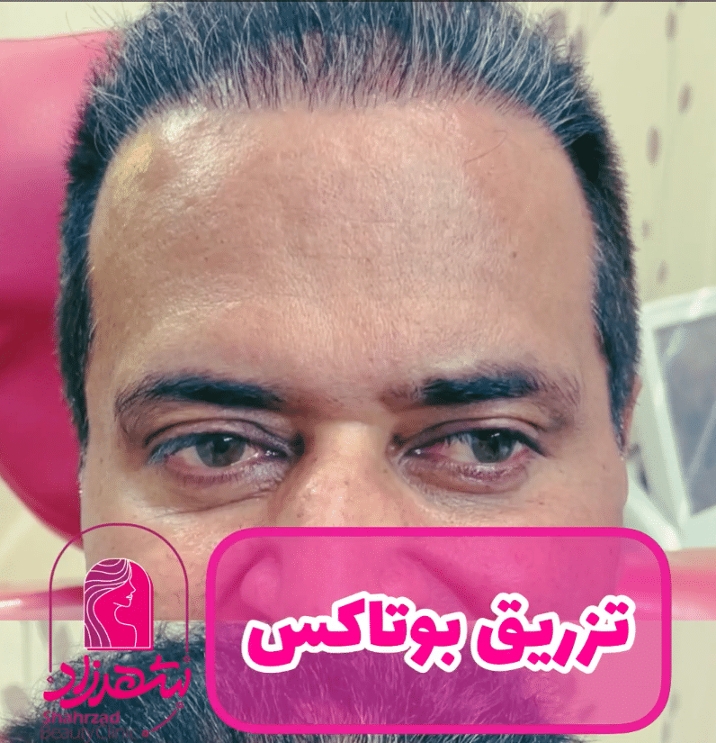 ویدئو نمونه
