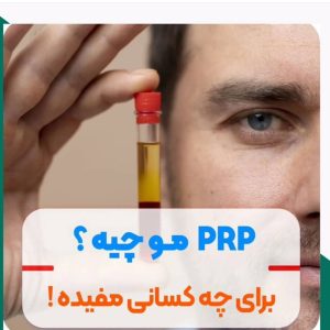 prp3