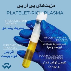 prp2