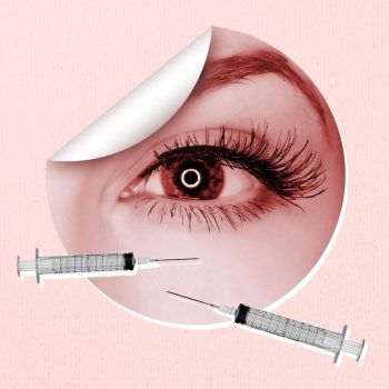 under eye1