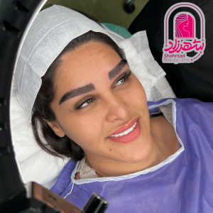 eyebrow17