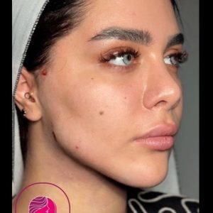 face-slimming11 Medium