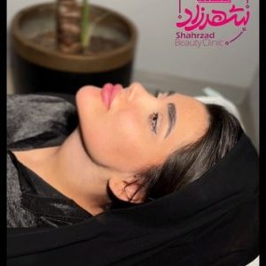 face-slimming5 Medium
