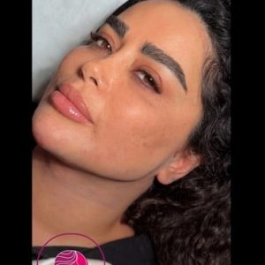 face-slimming6 Medium