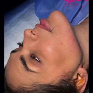 face-slimming8 Medium