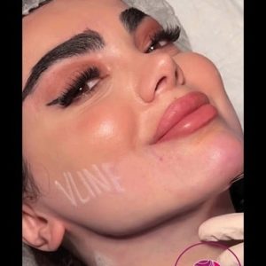 face-slimming9 Medium