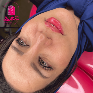 lipfiller18