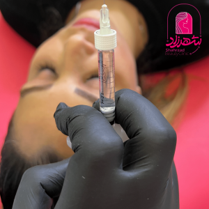 lipfiller19