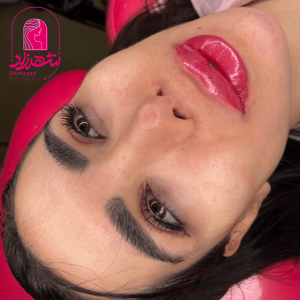 lipfiller21